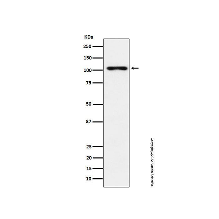 Recombinant Thyroid Peroxidase/TPO Antibody -    by Aladdin Scientific