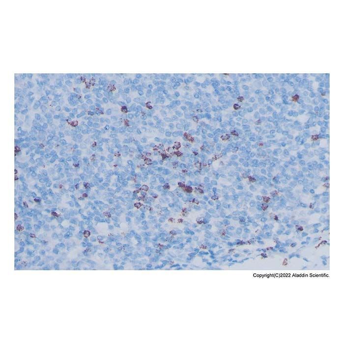 Recombinant TIA1 Antibody -    by Aladdin Scientific