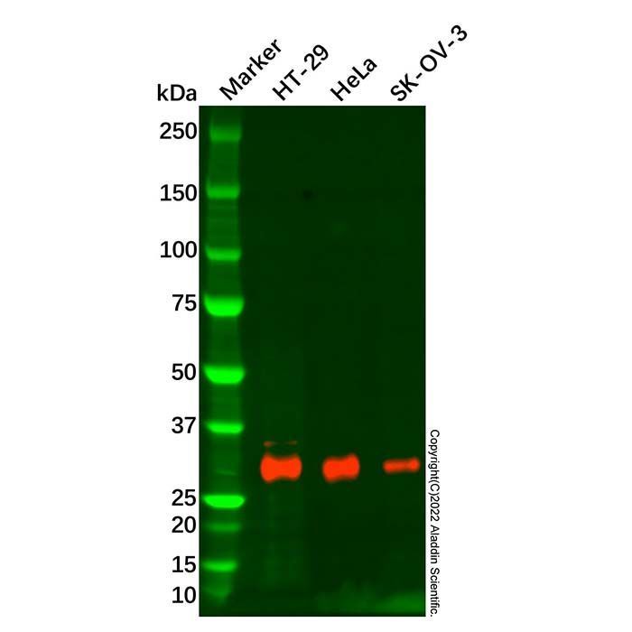 TIMP1 Antibody - by Aladdin Scientific