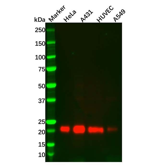 TIMP2 Mouse mAb - by Aladdin Scientific