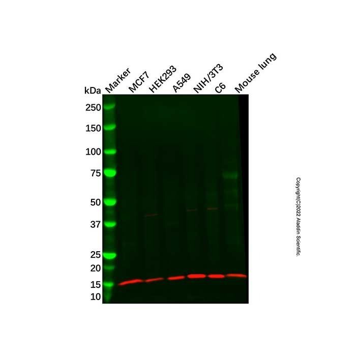 Recombinant TIP-1 Antibody -    by Aladdin Scientific