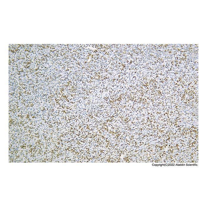 Recombinant TLE 1 Antibody -    by Aladdin Scientific