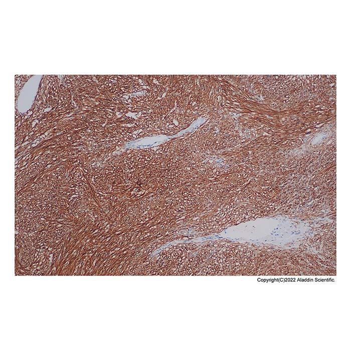 Recombinant TMEM16A Antibody -    by Aladdin Scientific