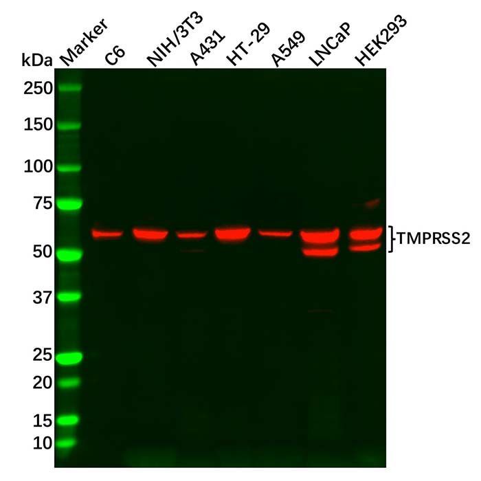 TMPRSS2 Antibody -    by Aladdin Scientific