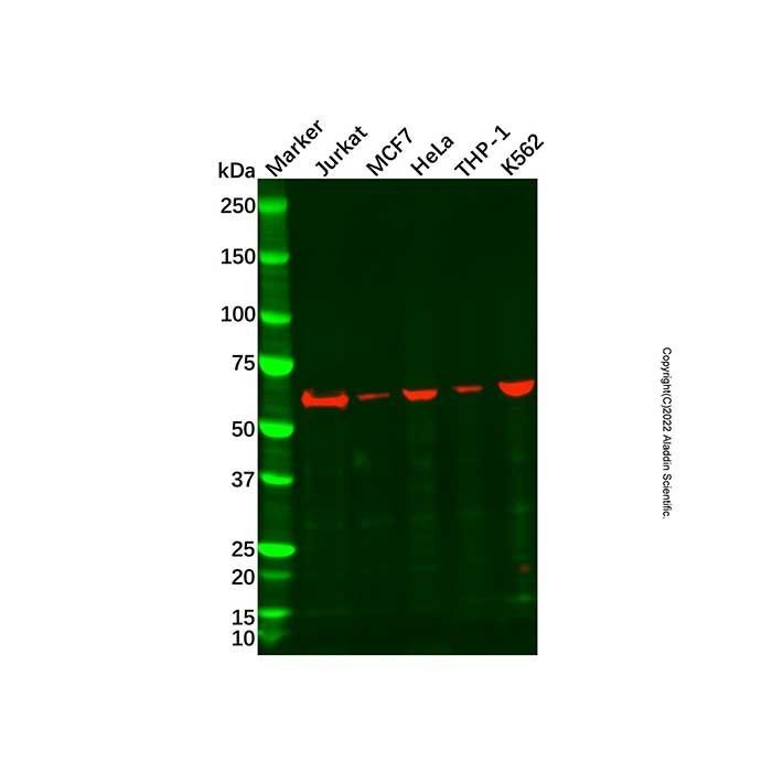 Recombinant TNF Receptor II Antibody -    by Aladdin Scientific