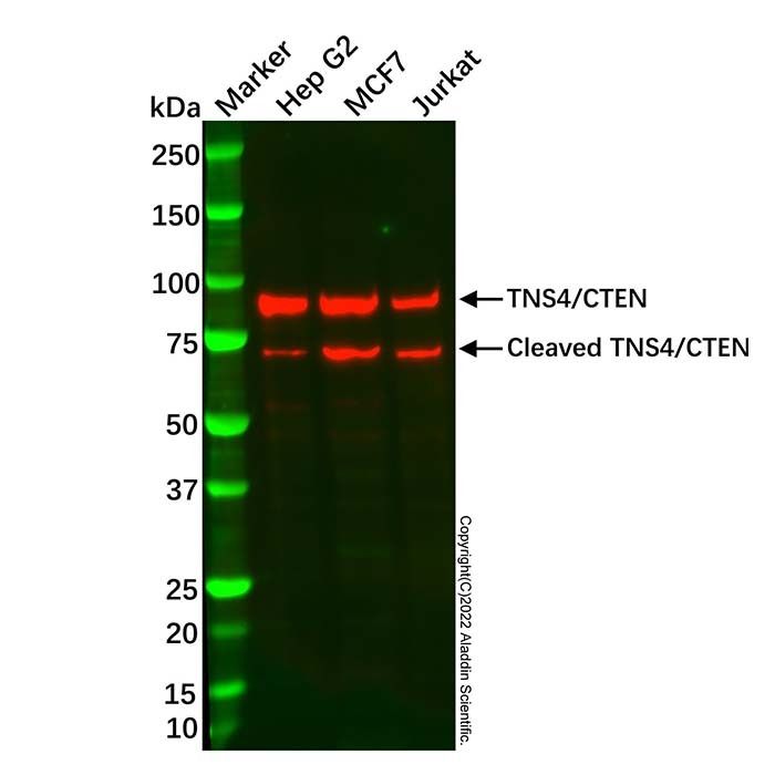 Recombinant TNS4/CTEN Antibody -    by Aladdin Scientific
