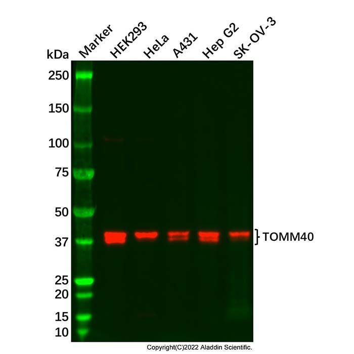 TOMM40 Antibody -    by Aladdin Scientific