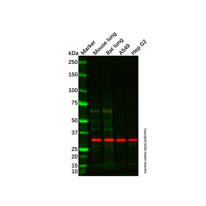 Recombinant TP53INP1 Antibody -    by Aladdin Scientific