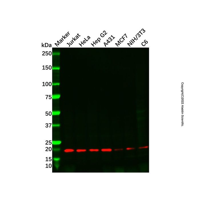 TPD52L2 Antibody -    by Aladdin Scientific