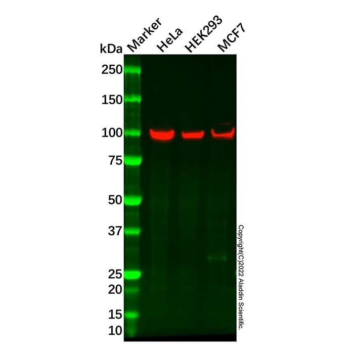 Recombinant TPX2 Antibody -    by Aladdin Scientific
