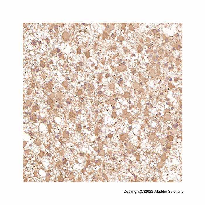 Recombinant TRAF6 Antibody -    by Aladdin Scientific