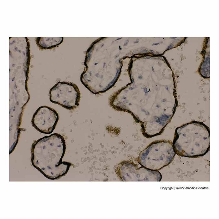 Anticuerpo recombinante del receptor de transferrina -    by Aladdin Scientific