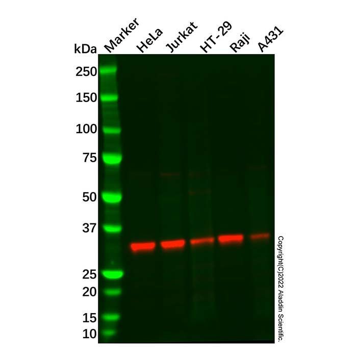 Recombinant TREX1 Antibody -    by Aladdin Scientific