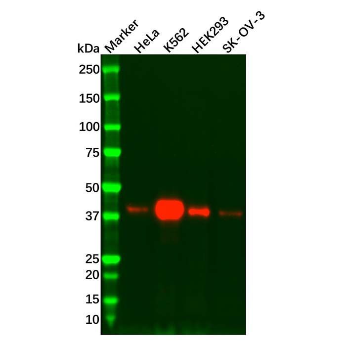 Recombinant TRIB3 Antibody -    by Aladdin Scientific