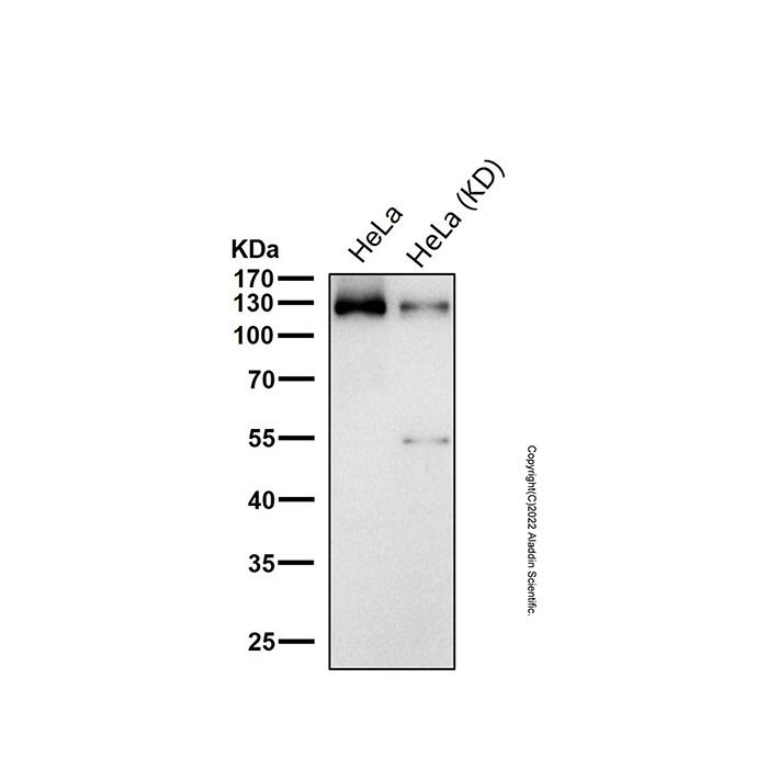 Recombinant TRIM24 Antibody -    by Aladdin Scientific