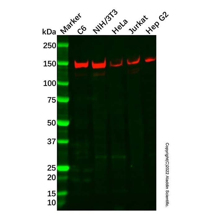 Recombinant Tripeptidyl peptidase II/TPPII Antibody -    by Aladdin Scientific