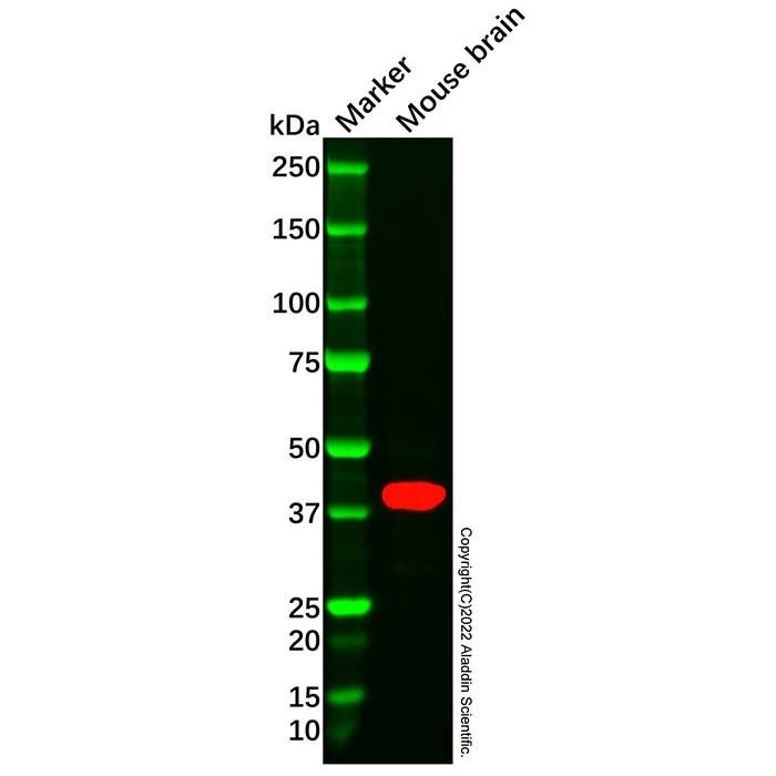 Recombinant Tropomodulin 2 Antibody -    by Aladdin Scientific