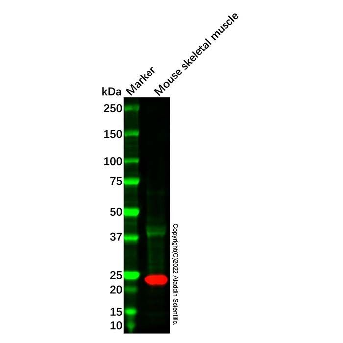 Recombinant Troponin I fast skeletal muscle Antibody -    by Aladdin Scientific