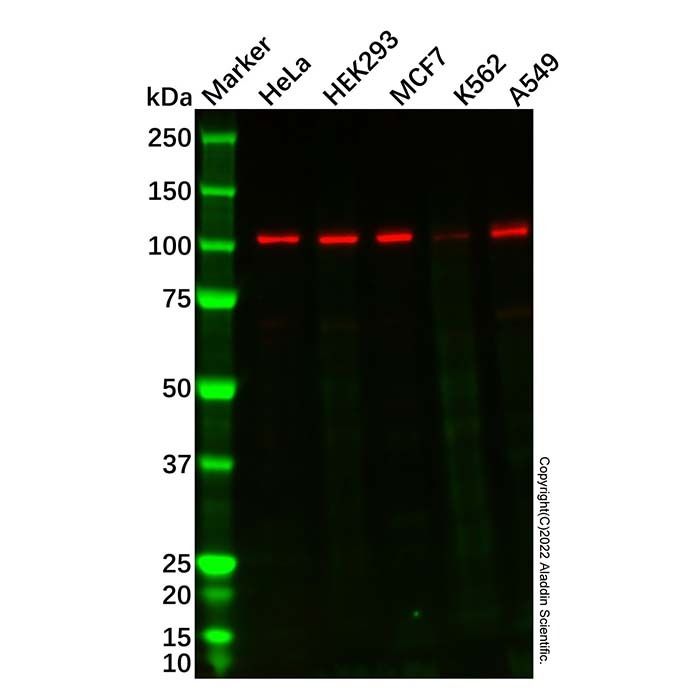 Recombinant TRPM8 Antibody -    by Aladdin Scientific