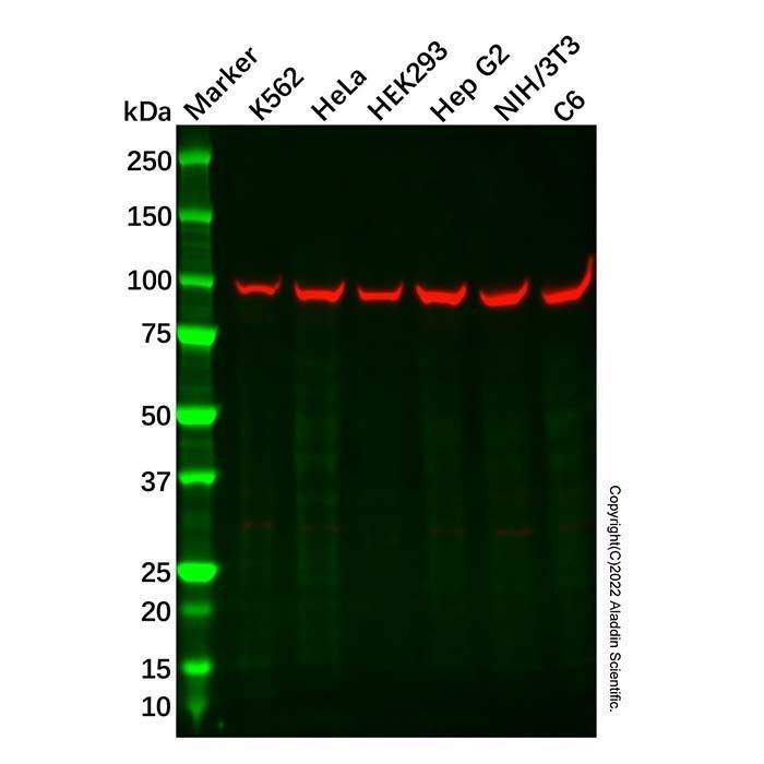 Recombinant TRPV5 Antibody -    by Aladdin Scientific