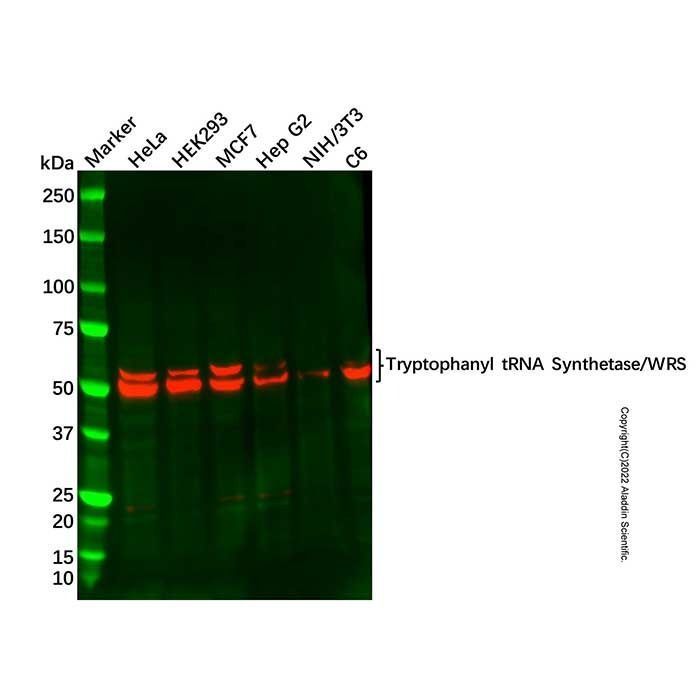 Recombinant Tryptophanyl tRNA Synthetase/WRS Antibody -    by Aladdin Scientific