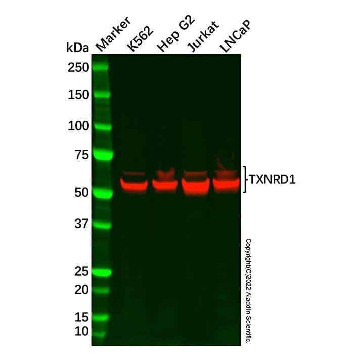 Recombinant TXNRD1 Antibody -    by Aladdin Scientific
