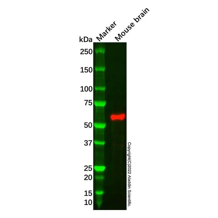 Recombinant Tyrosine Hydroxylase Antibody -    by Aladdin Scientific