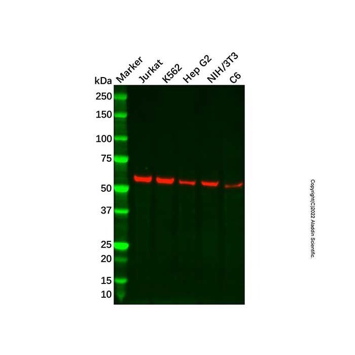 Recombinant UAP1 Antibody -    by Aladdin Scientific