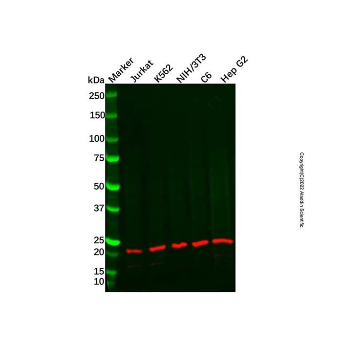 Recombinant UBE2B Antibody -    by Aladdin Scientific
