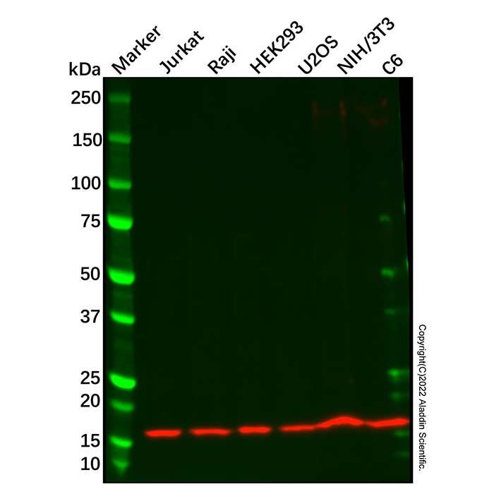 Recombinant Ube2N/Ubc13 Antibody -    by Aladdin Scientific