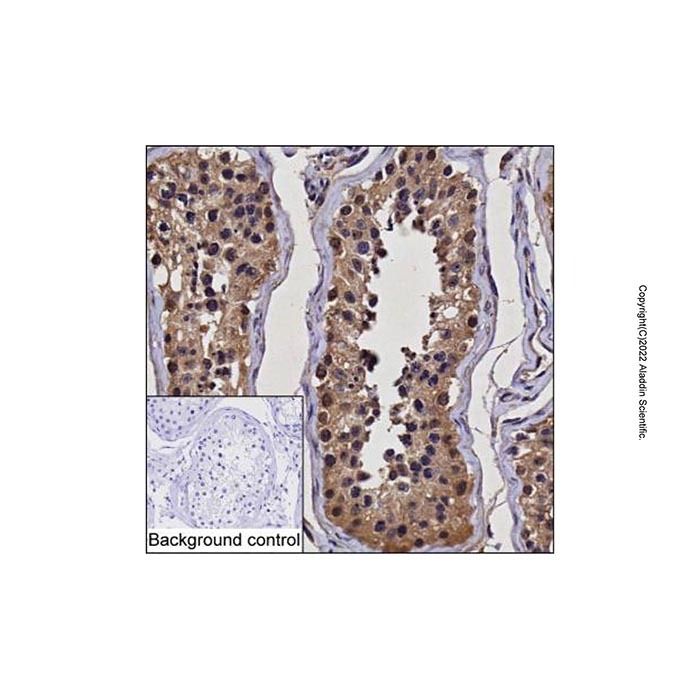 UBE2Z Mouse mAb -    by Aladdin Scientific
