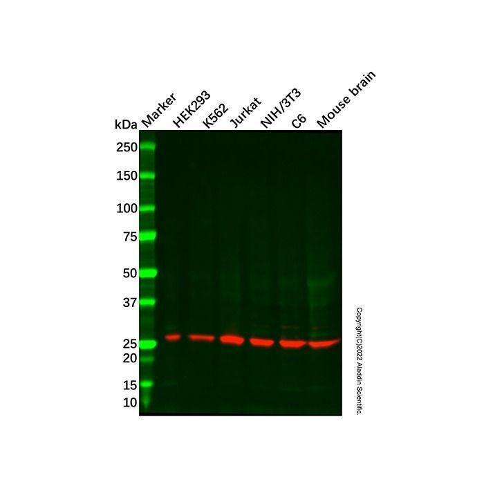 Recombinant UCHL3 Antibody -    by Aladdin Scientific