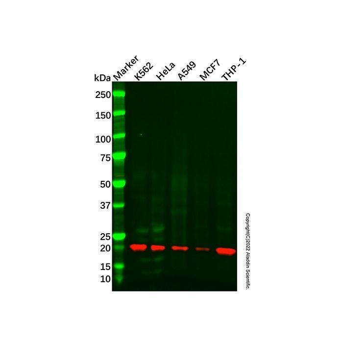Recombinant UFC1 Antibody -    by Aladdin Scientific