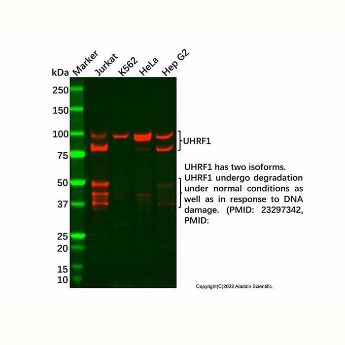 Recombinant UHRF1 Antibody -    by Aladdin Scientific