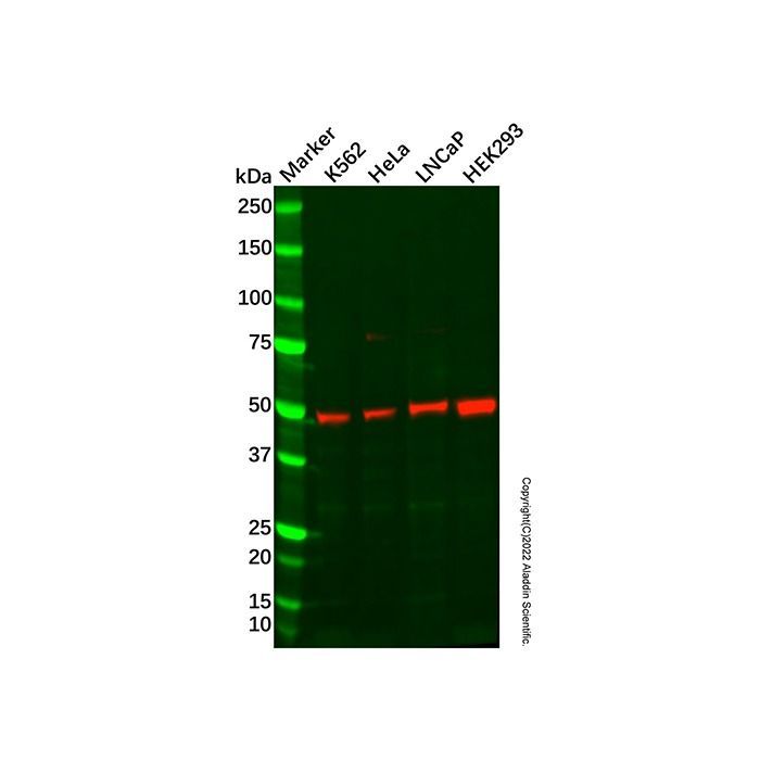 Recombinant ULK3 Antibody -    by Aladdin Scientific