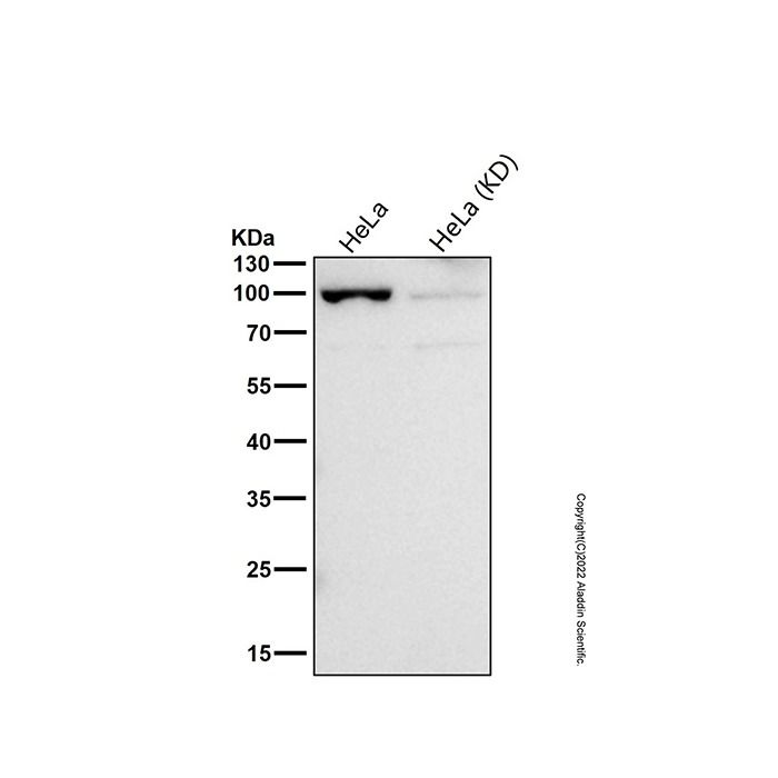 Recombinant USP13 Antibody -    by Aladdin Scientific