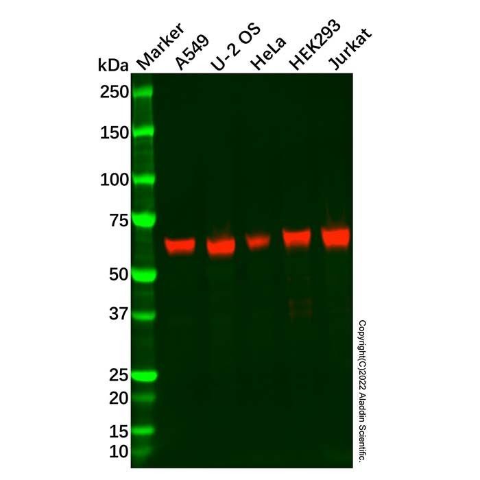 Recombinant USP22 Antibody -    by Aladdin Scientific