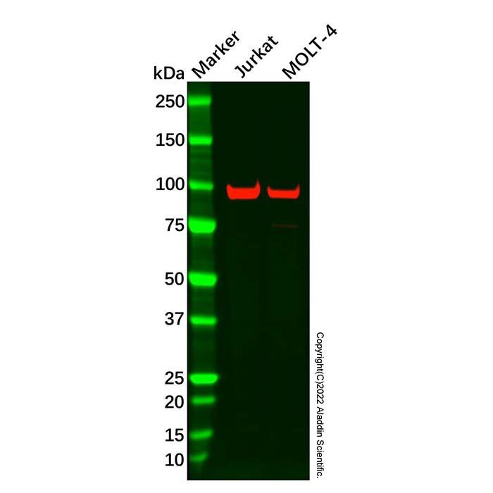 VAV1 Mouse mAb -    by Aladdin Scientific