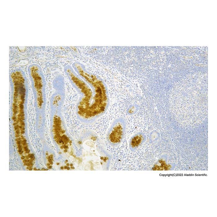 Recombinant VEGF Receptor 2 Antibody - by Aladdin Scientific