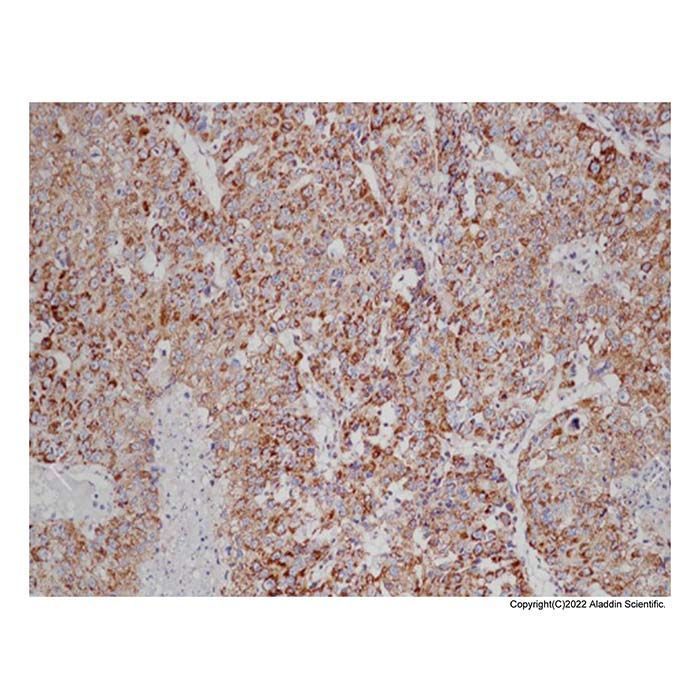 Recombinant VEGFA Antibody - by Aladdin Scientific