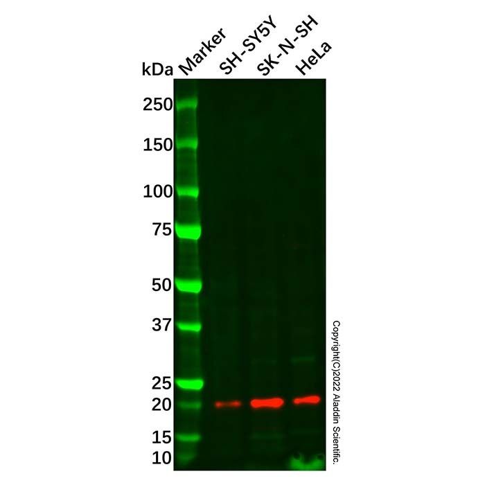 VILIP3 Mouse mAb -    by Aladdin Scientific