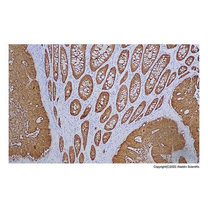 Recombinant Villin Antibody -    by Aladdin Scientific