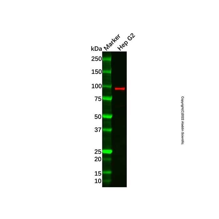 Recombinant Villin Antibody -    by Aladdin Scientific