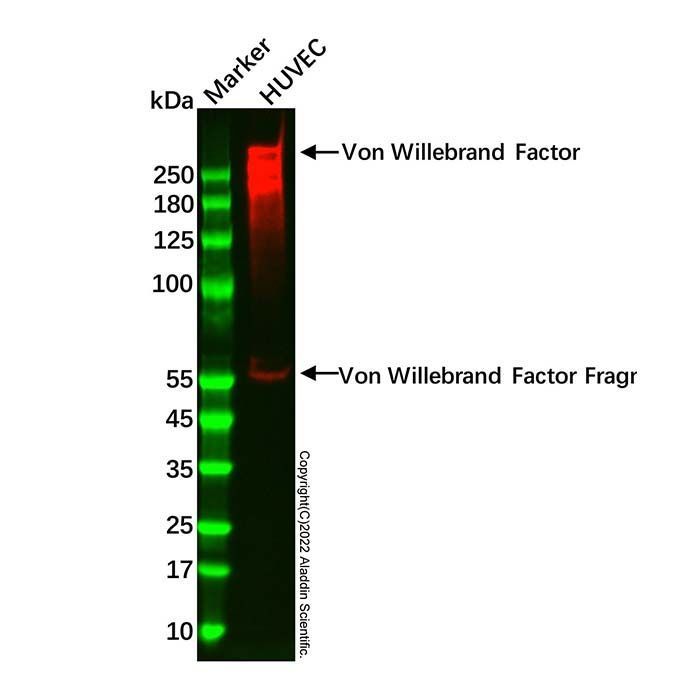Recombinant Von Willebrand Factor Antibody -    by Aladdin Scientific