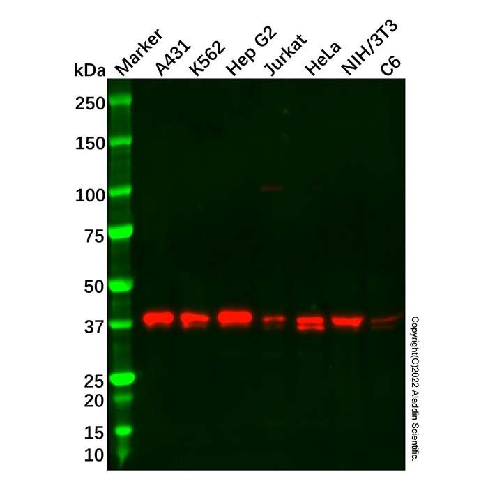 Recombinant VPS26 Antibody -    by Aladdin Scientific