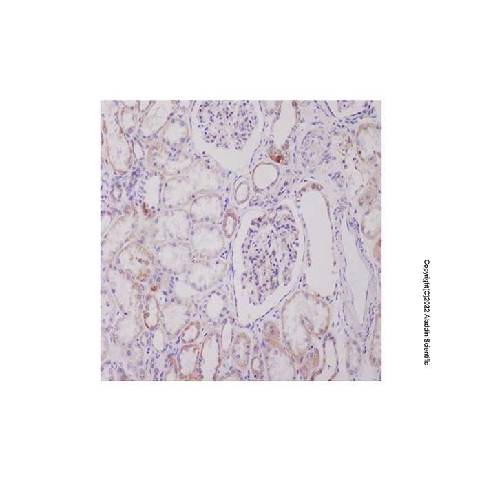 Recombinant VPS34 Antibody -    by Aladdin Scientific