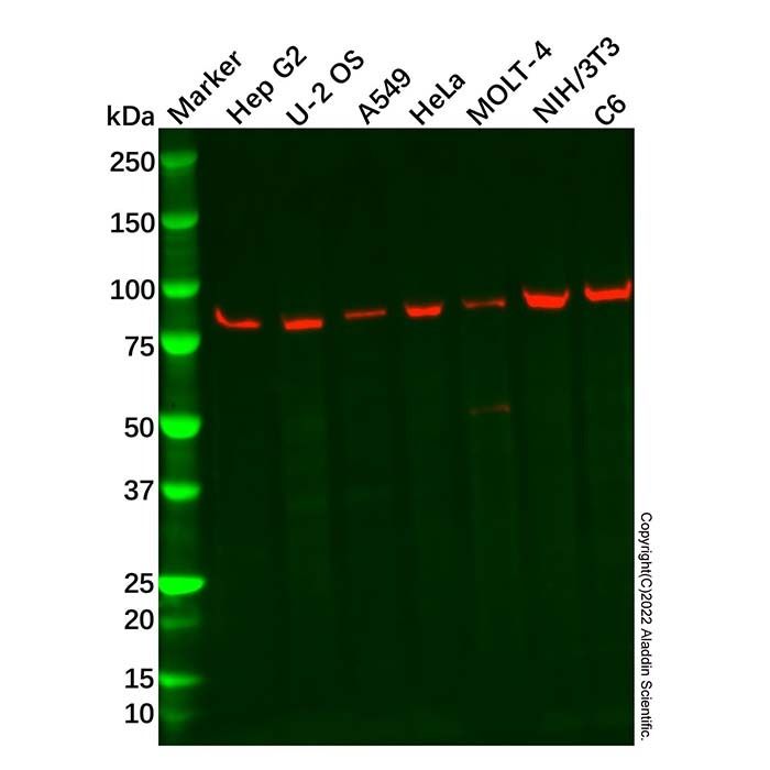 Recombinant VPS35 Antibody -    by Aladdin Scientific