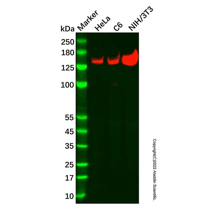 Recombinant WAPL/FOE Antibody -    by Aladdin Scientific