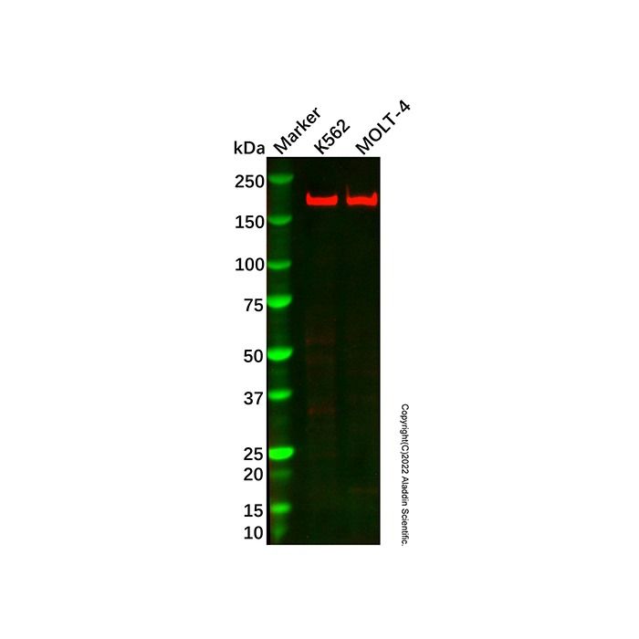 Recombinant WRN Antibody -    by Aladdin Scientific