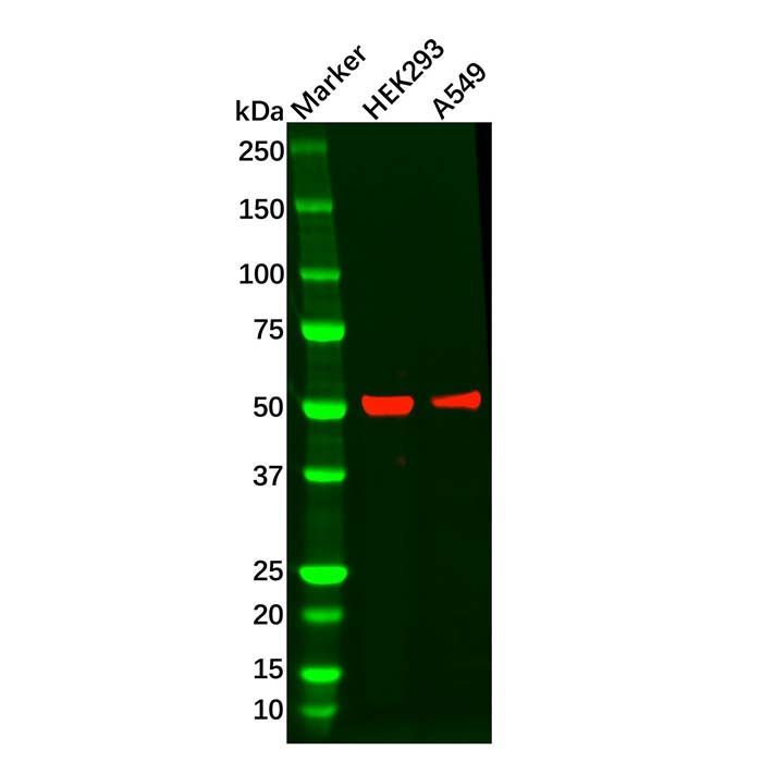 Recombinant Wilms Tumor Protein Antibody -    by Aladdin Scientific